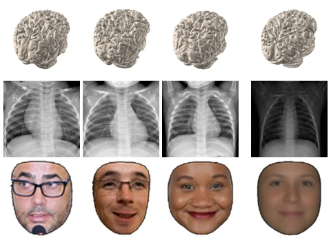 Atlases Are Already Inside: Recovering Population Templates from Pretrained Diffusion Models