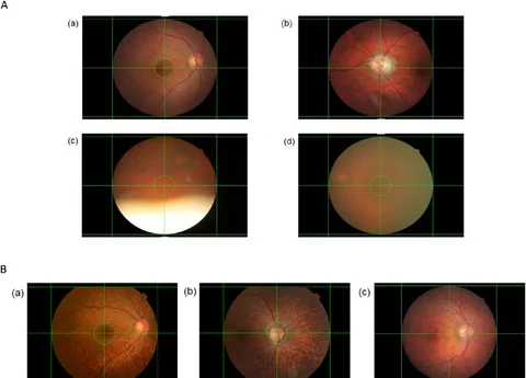 Deep-learning-based Pre-diagnosis Assessment Module for Retinal Photographs: A Multicenter Study